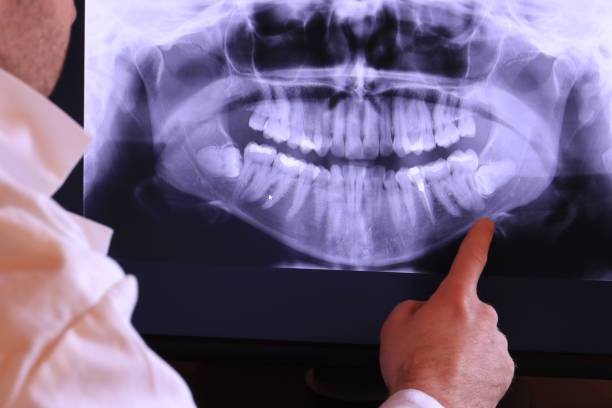 Best Emergency Dentist for Knocked-Out Tooth in Manly, IA